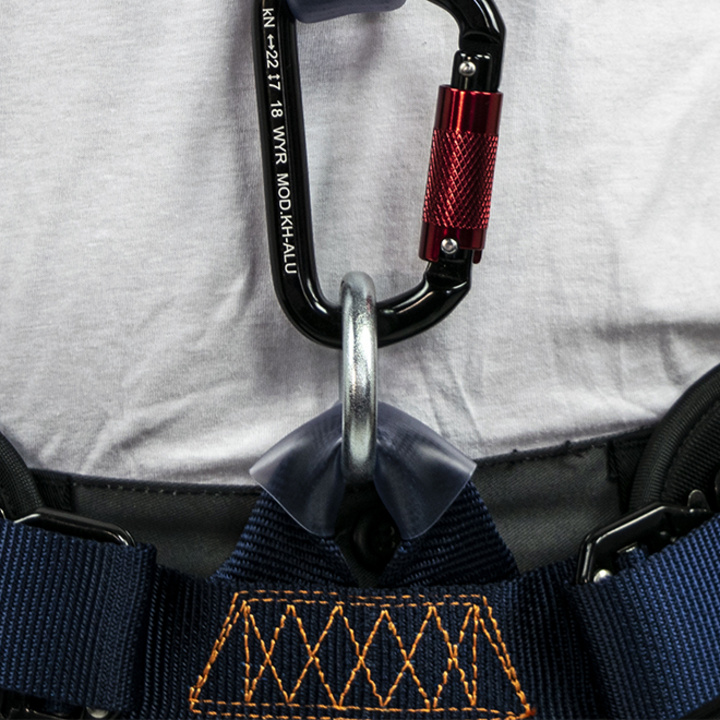 Abdominal ring